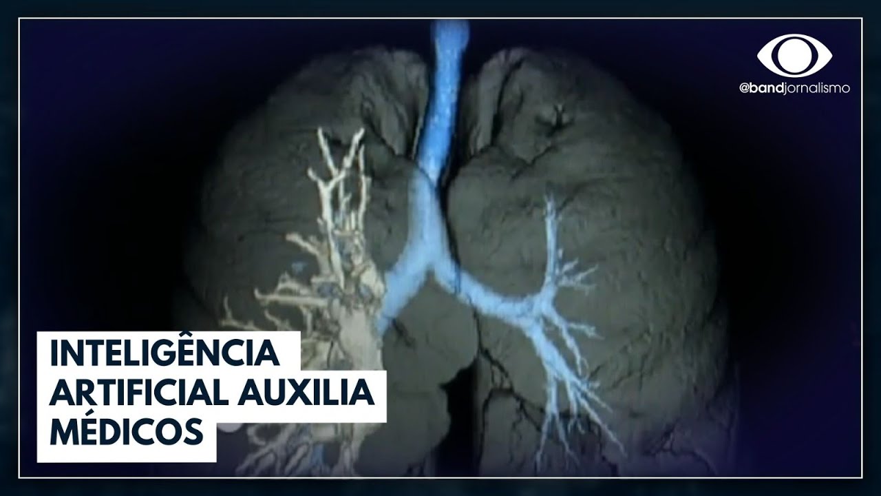Inteligência artificial auxilia médicos em diagnósticos I Jornal da Band
