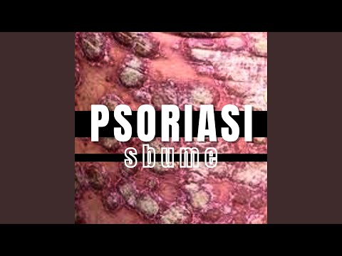 PsOriAsi