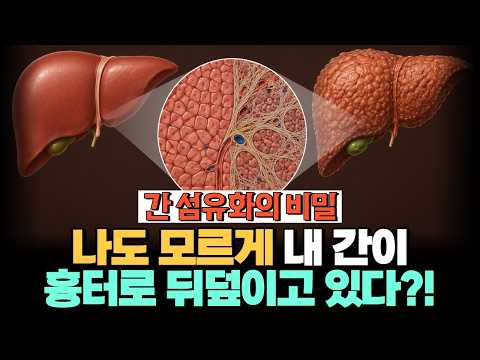 나도 모르게 내 간이 섬유화되는 이유? 간에 생기는 흉터의 진실!