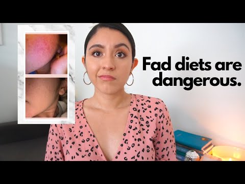 How Fad Diets Destroyed My Health | How to spot a fad diet!