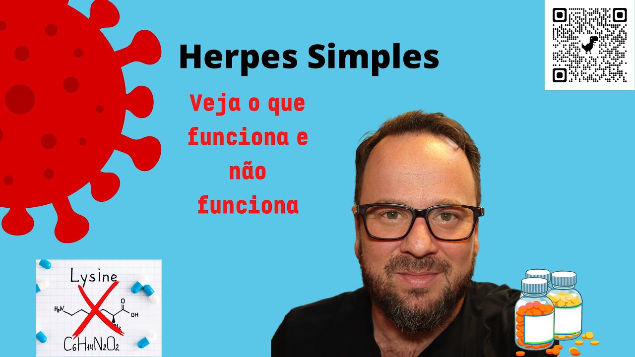 Herpes simples - o que funciona e o que é mito? Renato Cassol Infectologista