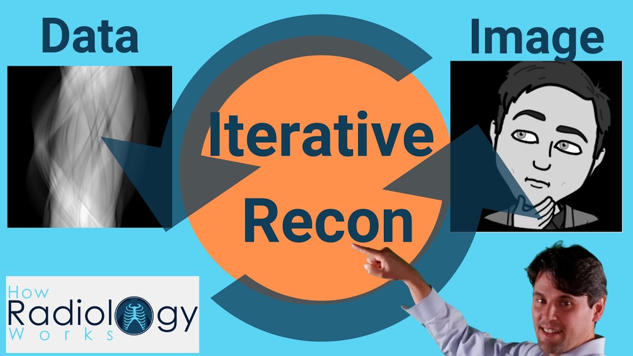 Iterative Reconstruction ( How it works )