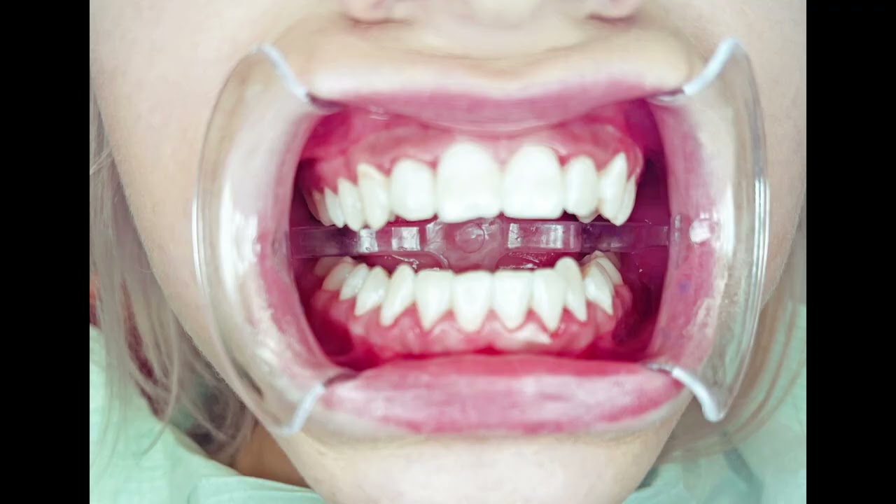 Grażyna Andruszkiewicz-112