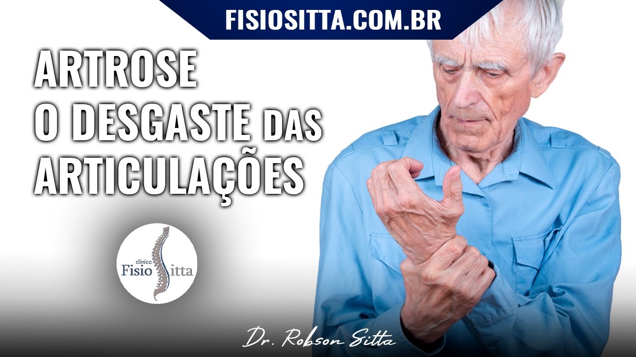 ARTROSE DESGASTE da CARTILAGEM ARTICULAR OSTEOARTROSE SINAIS SINTOMAS e TRATAMENTO Dr. Robson Sitta