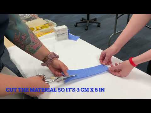 How to Make a Figure 8 Orthosis for Swan Neck Deformity