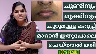 How To Remove Darkness Around Mouth And Nose Naturally At Home| Malayalam| Devuz Home