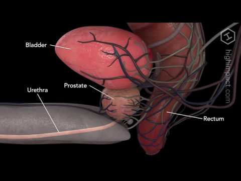 Fluorchinolon für die Behandlung von Prostatitis Vorrichtungen zur Stimulation der Prostata