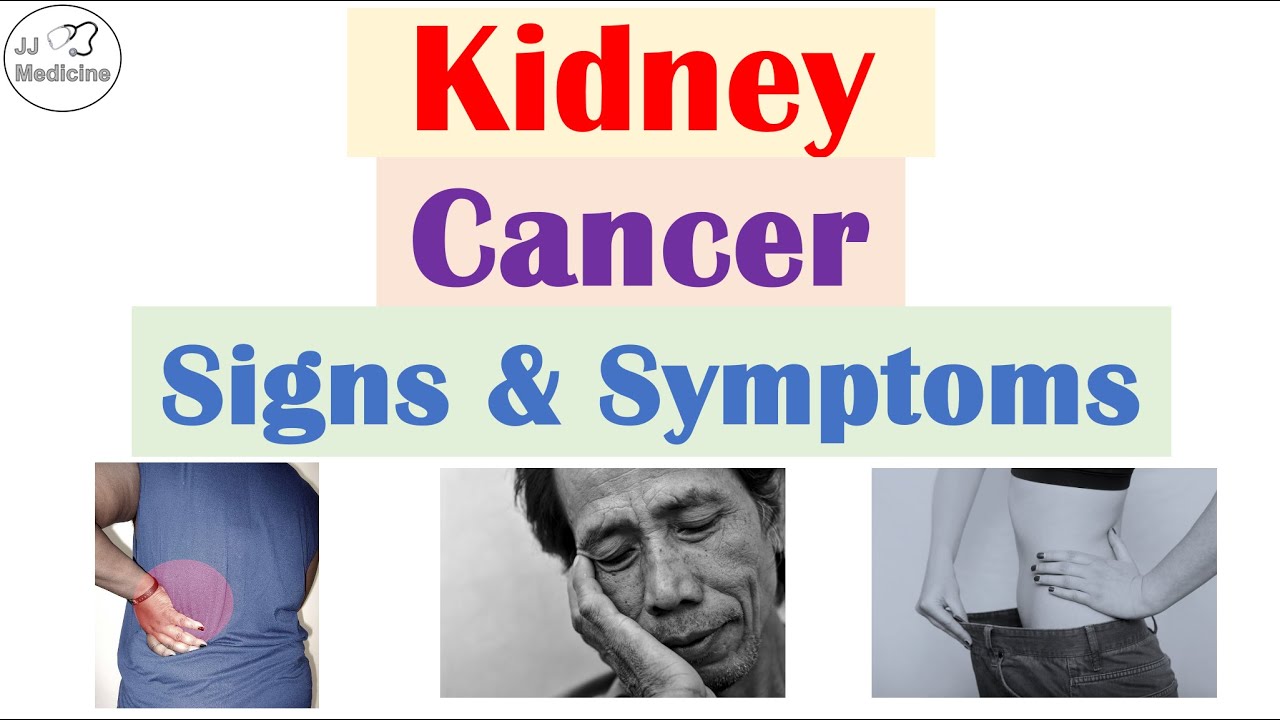 Kidney Cancer (Renal Cell Carcinoma) Signs and Symptoms (& Why They Occur)