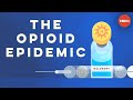 What causes opioid addiction, and why is it so tough to combat? - Mike Davis