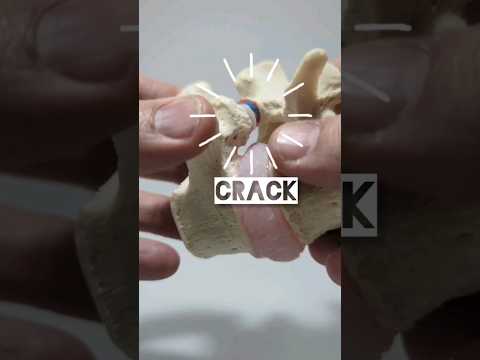 Sound Source of Cracking Joint _ Do you wonder where the sound is coming from?