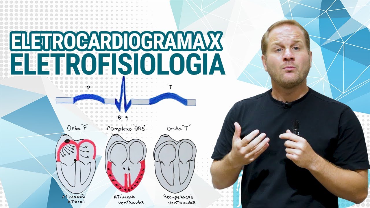 Eletrocardiograma X Eletrofisiologia