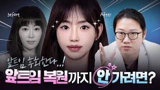 앞트임 후회해요 앞트임 복원 없이 한 번에 성공하는 방법!