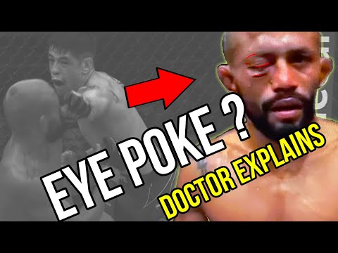 Brandon Moreno UFC 283 : What happened to Figuereidos EYE??? (Doctor Explains)