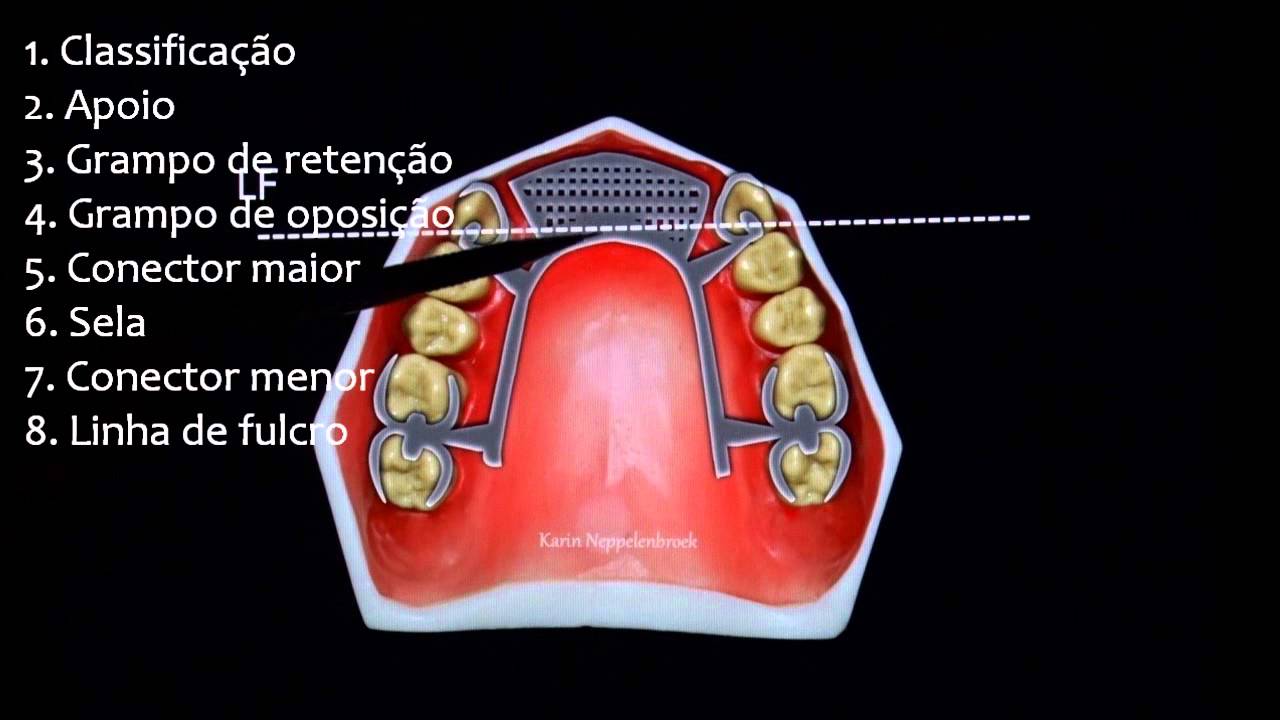 Planejamento Classe IV de Kennedy
