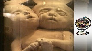 The Terrible Toll of Russia&#39;s Secret Nuclear Accident (2001)