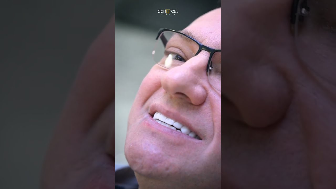 Mr. Emilio Got A Happy Smile Made By Zirconium