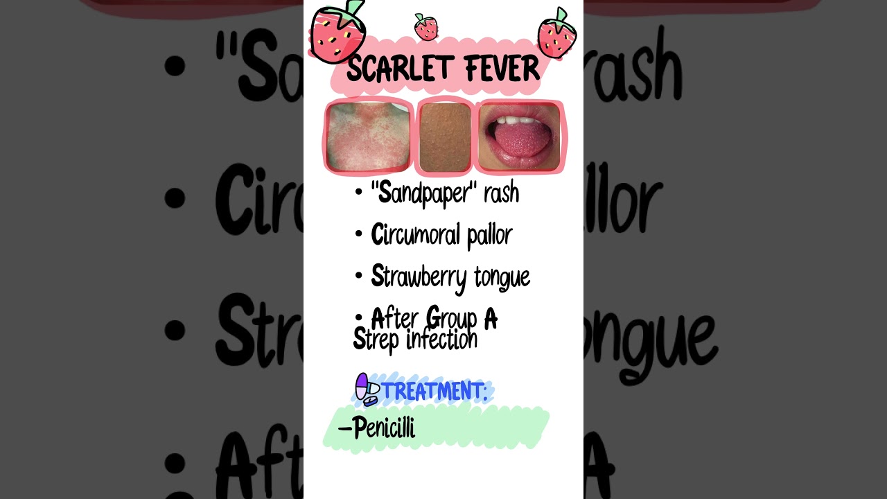 Top Pediatric Rashes Explained 👶 | High-Yield Exanthems for Step 1 & Step 2 CK