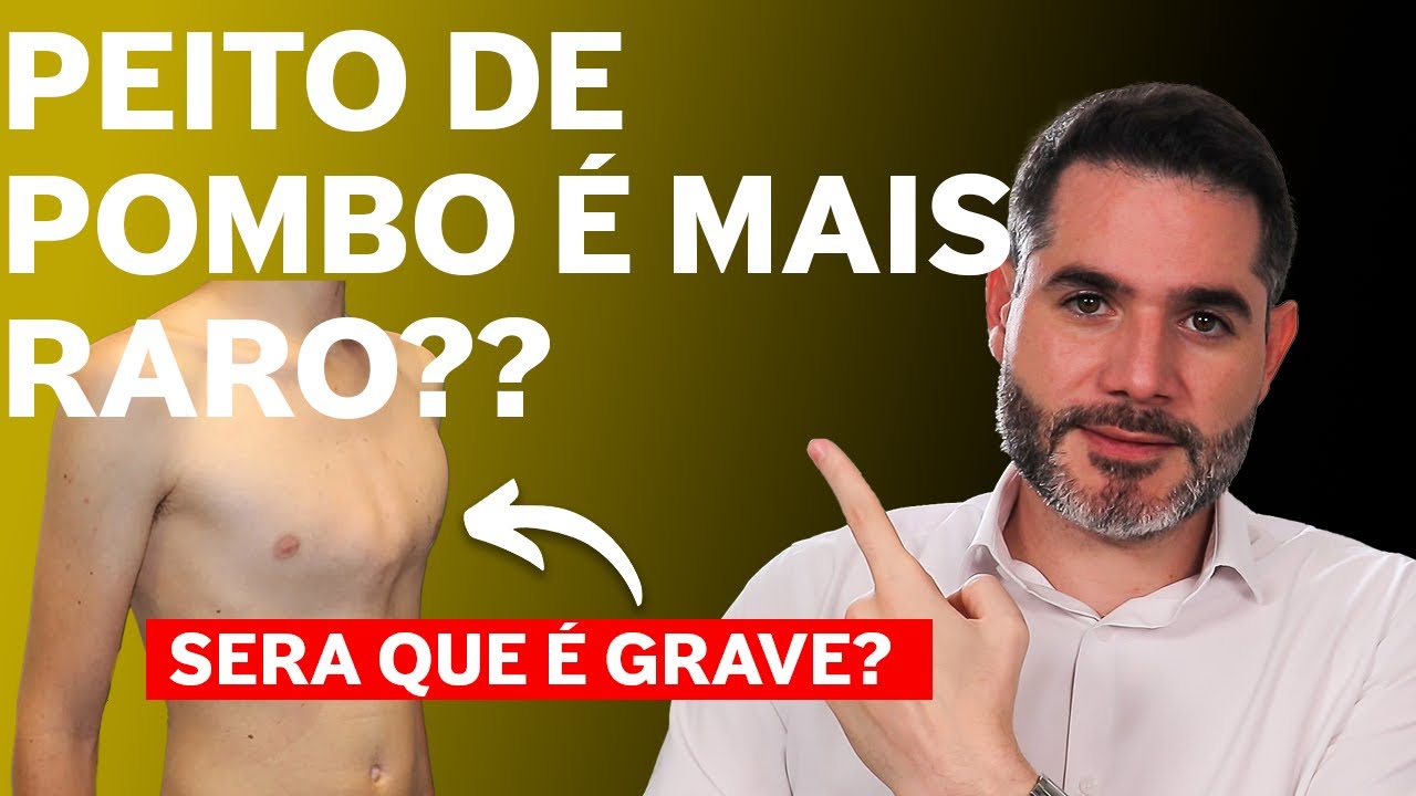 Pectus Carinatum Explorado: Causas, Sintomas e Opções de Tratamento