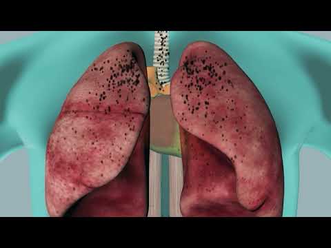 XPOWER AP-1500D 4-Stage Commercial HEPA Air Filtration System Video