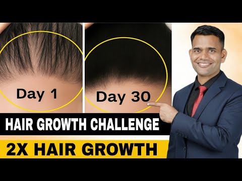 2X HAIR GROWTH  STOP HAIR FALL NATURALLY | Ayurvedic Hair Regrowth Formula