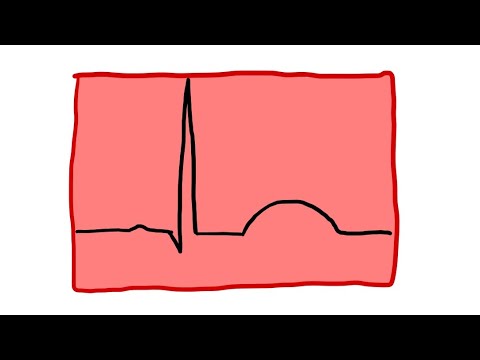 Po mojemu: EKG cz. 1