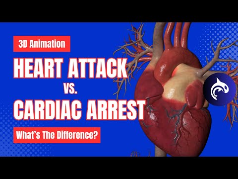 Cardiac Arrest vs Heart Attack - What's the Difference? - 3D Animation