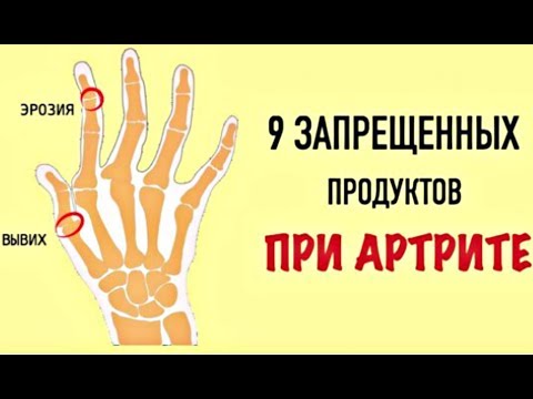 Эти 9 продуктов — могут разрушить суставы! Врачи настоятельно рекомендуют сменить их