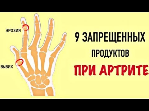 Шейный отдел позвоночника критерий Суставы болят таблетки