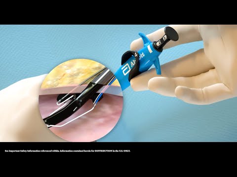 US Perclose ProStyle Single Device Deployment Animation