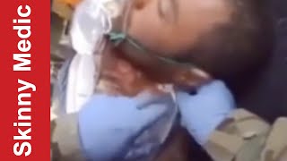 How to Treat Neck Injuries (Blunt and Penetrating)