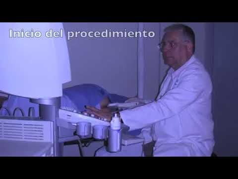 Malattia focale della prostata Gli effetti delle radiazioni per il cancro alla prostata