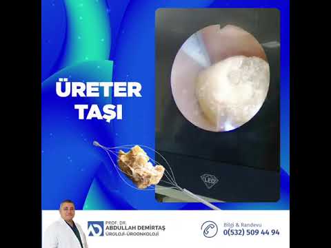 Kısa Video