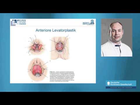 Kerzen wirksam bei der Behandlung von Prostata-Adenom Bindungen von chronischer Prostatitis