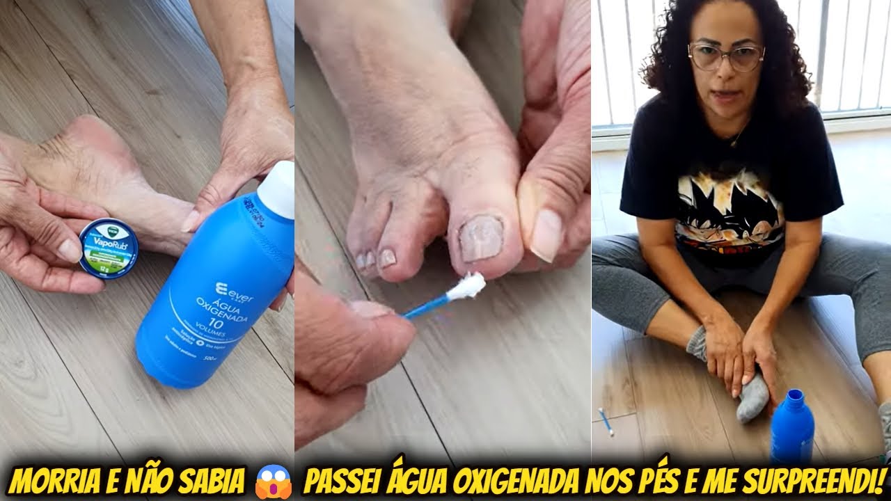 MORRIA E NÃO SABIA 😱 PASSEI ÁGUA OXIGENADA NOS PÉS E ME SURPREENDI COM O RESULTADO 🧹🧙‍♀️