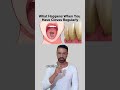 What Happens When You Have Cloves Regularly