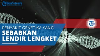 Cystic Fibrosis, Satu Jenis Penyakit Genetika yang Menyebabkan Lendir di Dalam Tubuh Menjadi kental