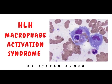 OSTEOGENIC TX II FLETCHERS 5TH E II ROBBINS 10TH E II POST GRADUATE LEARNING II DrJIBRANAHMED