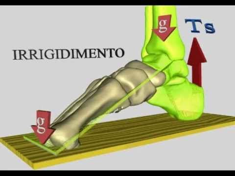 Dolore alle gambe posteriori negato Malyshev di ernia intervertebrale
