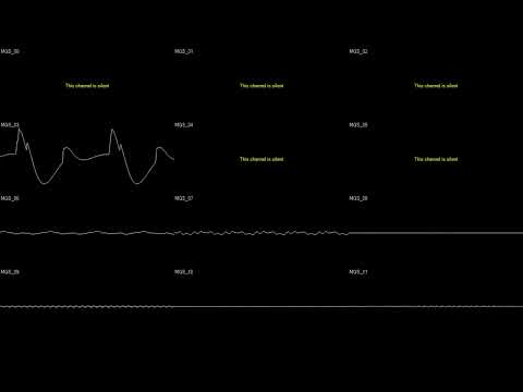 Metal Gear Solid - Warhead Storage - Oscilloscope Deconstruction