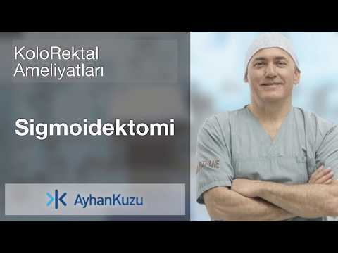 Kolorektal Ameliyatları #6 - Sigmoidektomi