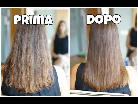 Quali vitamine a una farmacia per capelli Risposte su un aleran da una perdita di capelli per donne