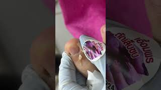 Ep_8476 Foot nails skin removal 👣 เห็นไหม..ดำ ๆ หายไปแล้ว 😄 (clip from Thailand)