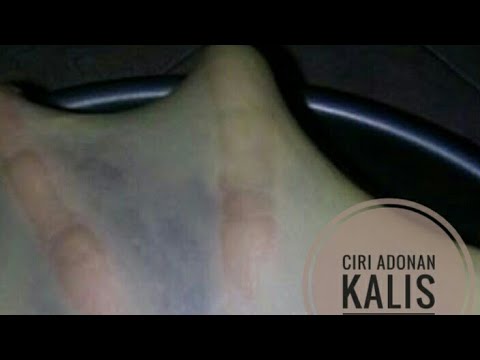 Peningkatan kolesterol selama penurunan berat badan Diet yang efektif untuk menurunkan 20 kg