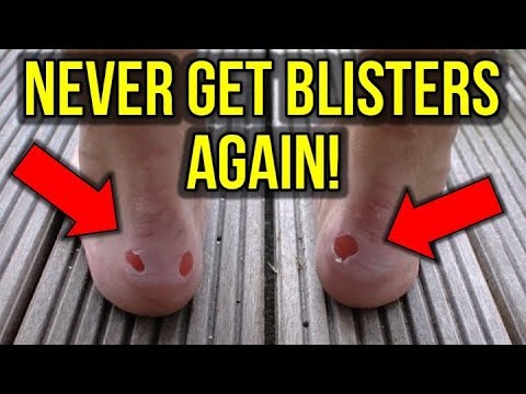 THE SECRET TO NEVER GETTING BLISTERS FROM YOUR FOOTBALL BOOTS!