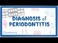 Diagnosis of Periodontitis