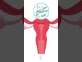 BV Vs Yeast Infection How To Tell The Difference