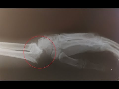 Raph Trinidad One Battery @ Republic Wake park