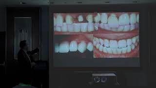 LMT 2023 Chicago - Luke Kang - Full Mouth Cases: Color and Contour Precision