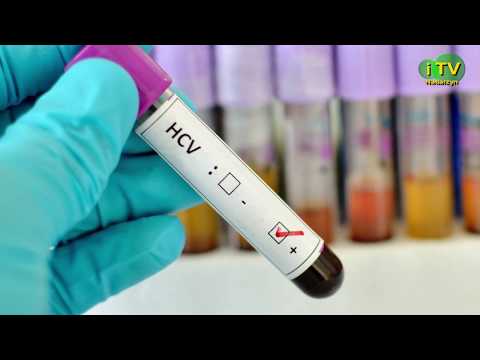 Zaproszenie na turniej badmintona