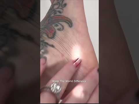 Rechargeable Electric Foot Callus Remover